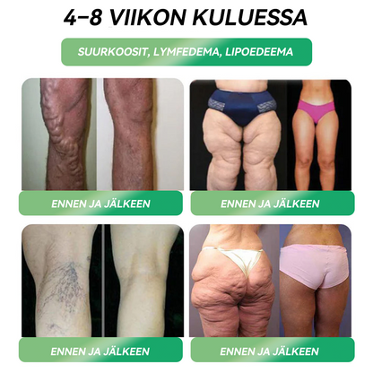 Virallinen Kauppa | 𝙃𝐻𝑽𝖡®💃𝐺𝐿𝑃-𝟏 𝑺𝑰𝑿 𝑰𝑵-𝑶𝑵𝑬 Terveysratkaisu Suun kautta otettava neste (Vain yksi annos päivässä — näkyviä tuloksia jo 7 päivässä)  ✅ Lihavuuteen, sydän- ja verisuoniterveyteen, diabetekseen, uniapneaan, nivelongelmiin ja muuhun